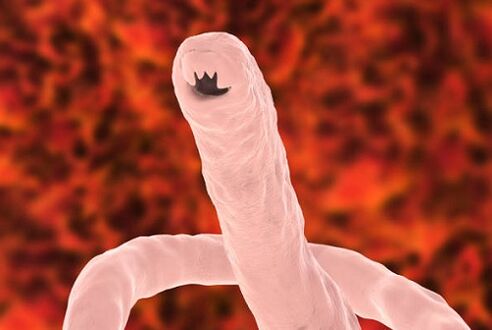 human parasite worm