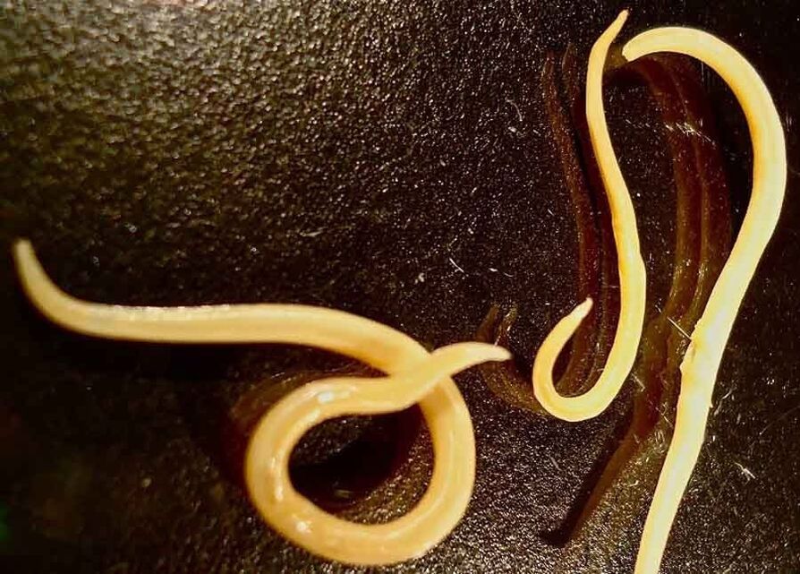 Pinworms in the human body