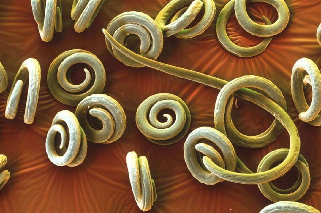 worms parasites from the human body