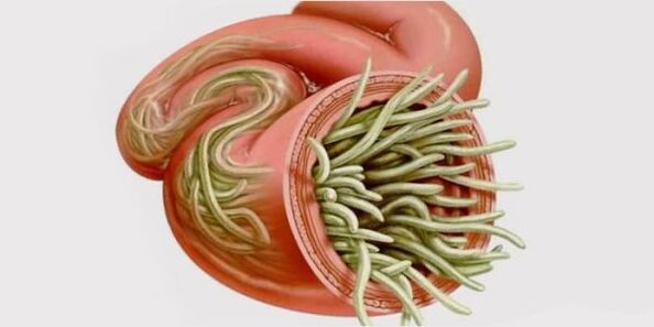 worms in humans